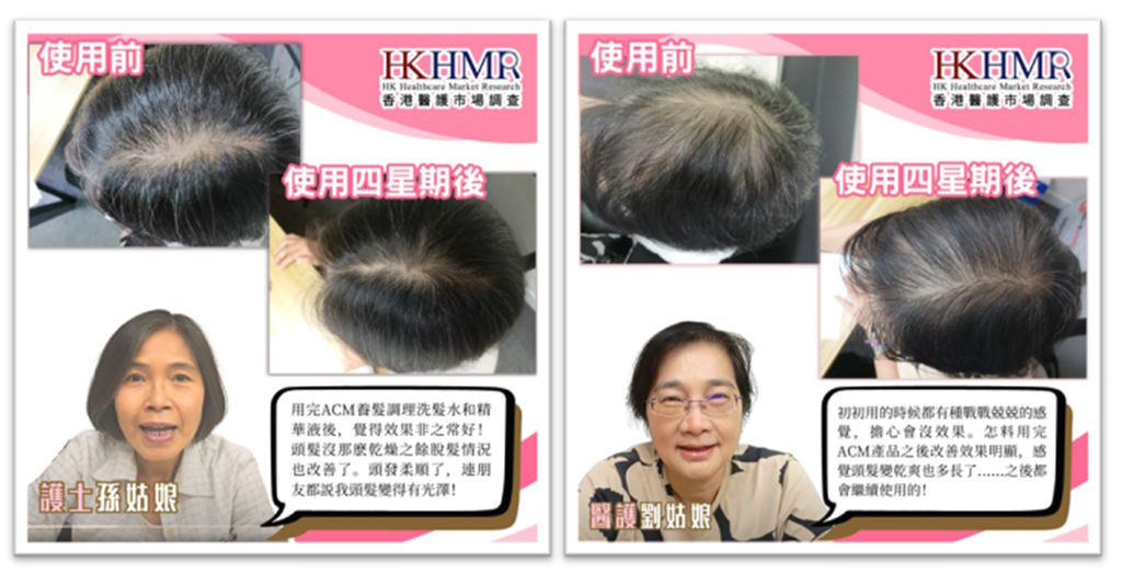 ACM養髮調理洗髮水和精華液